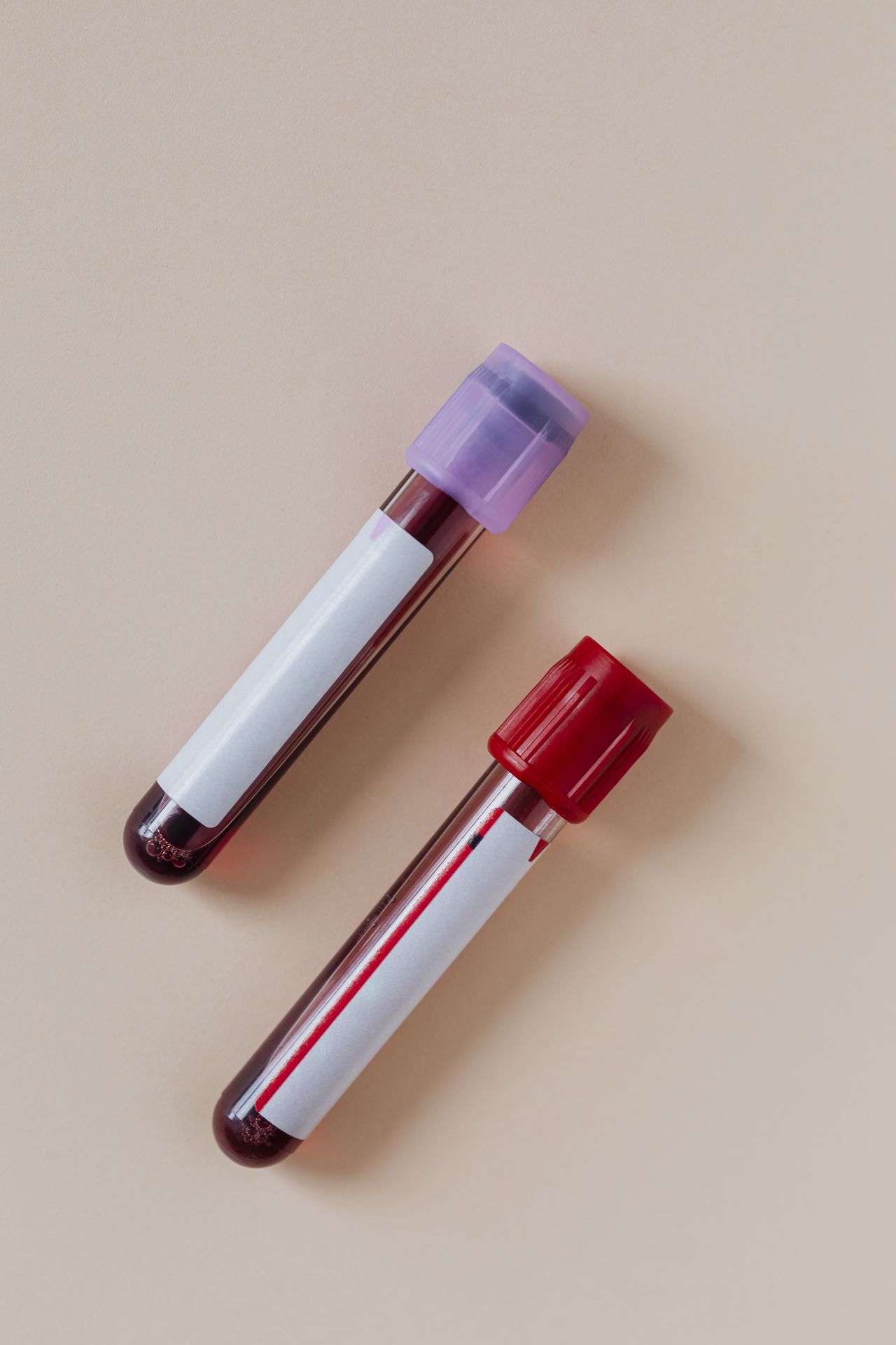 Blood test full tubes