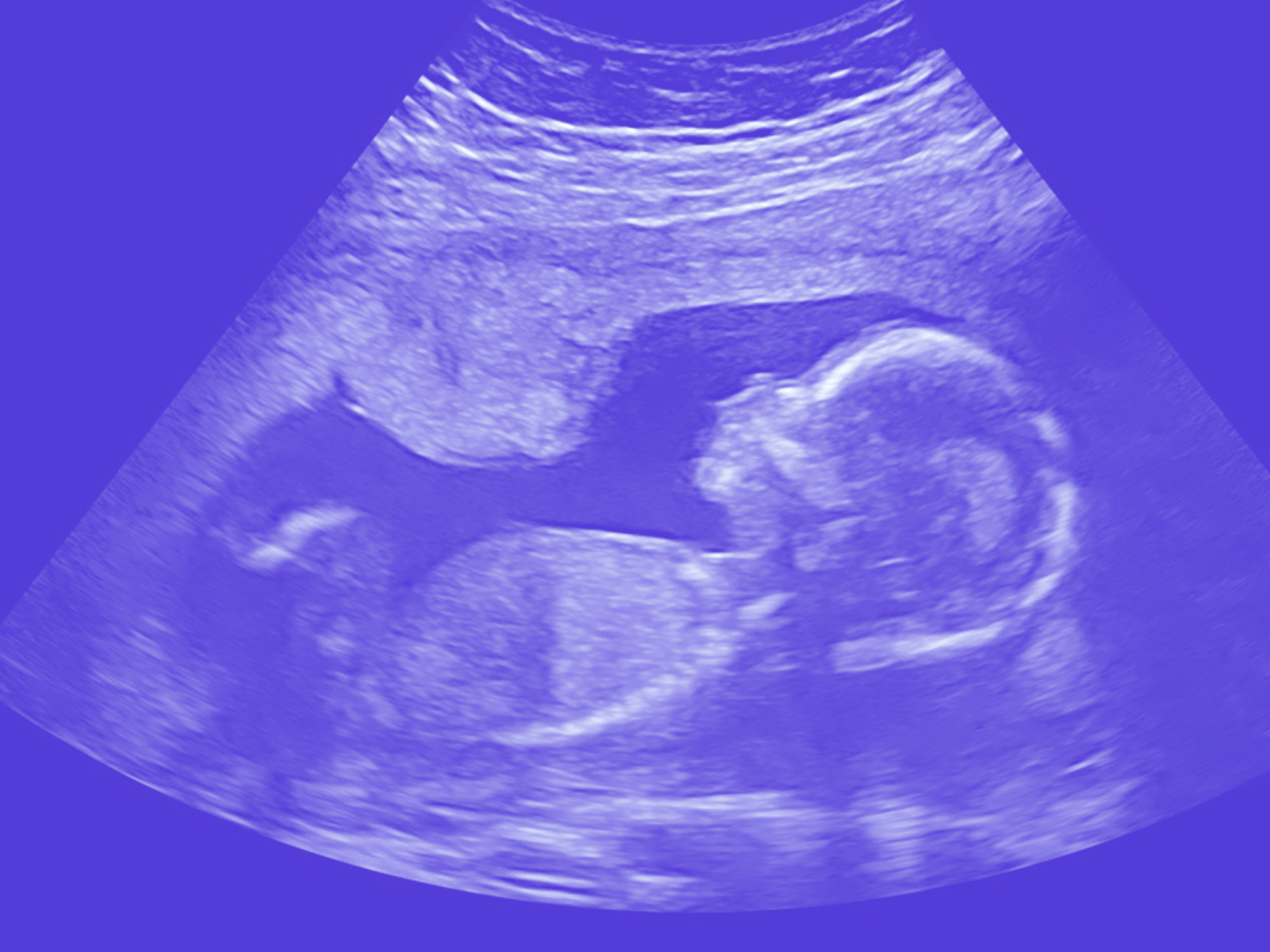 Baby Scan