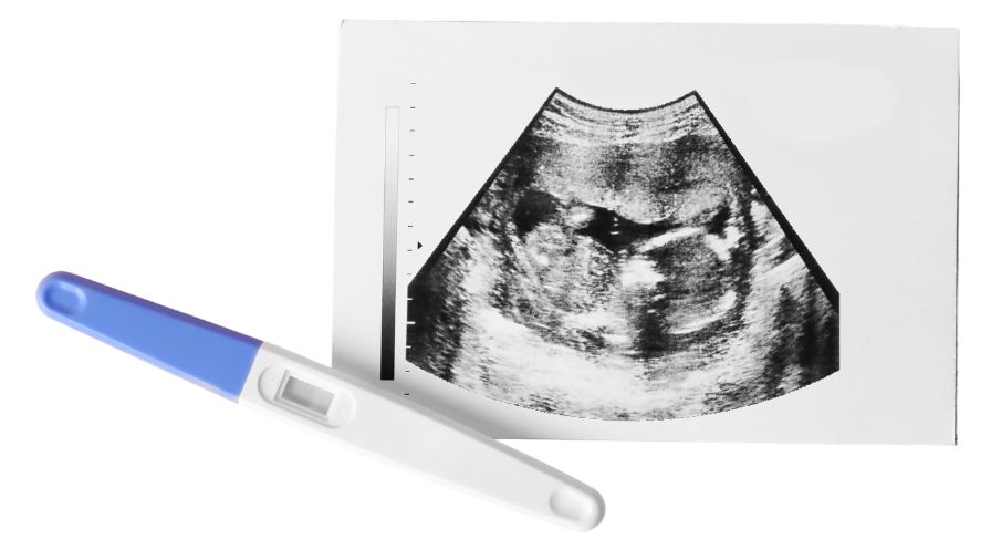 Early Pregnancy Scan