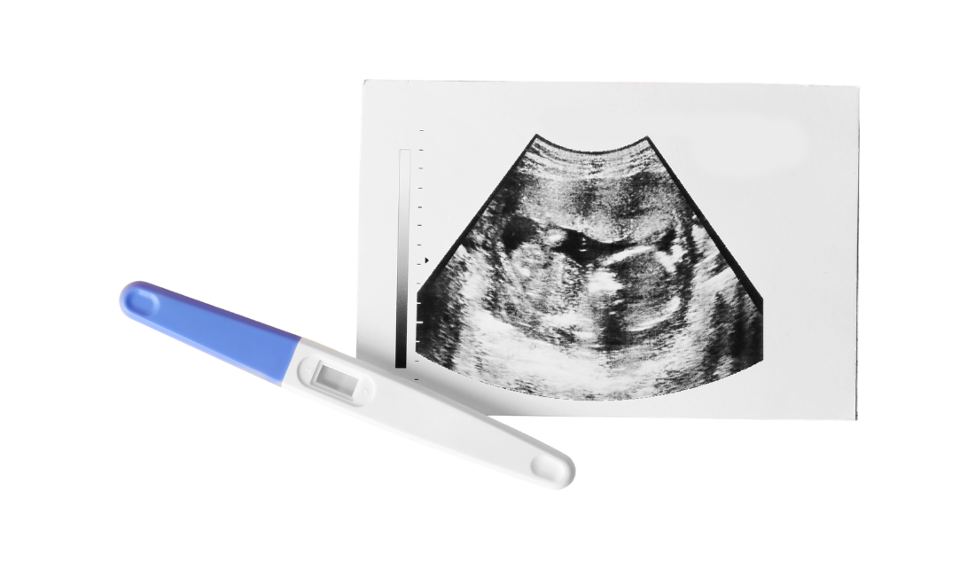 Early Pregnancy Reassurance Scan