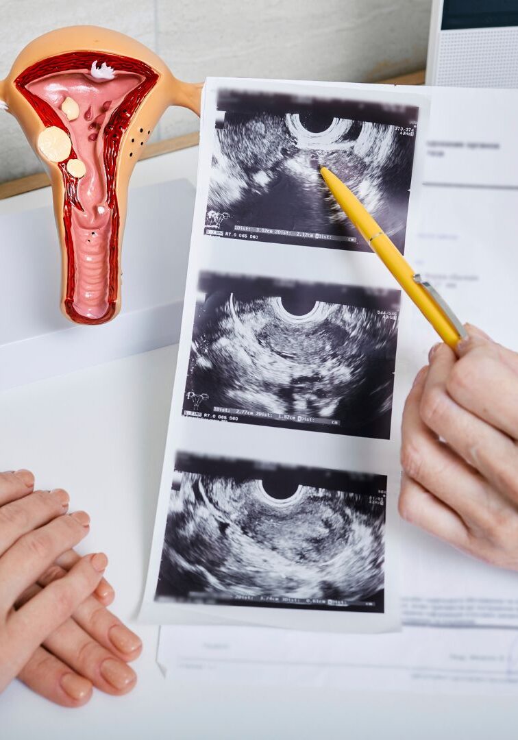 Gynaecology Scans for Insight